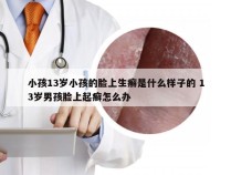 小孩13岁小孩的脸上生癣是什么样子的 13岁男孩脸上起癣怎么办