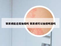 银屑病能适度抽烟吗 银屑病可以抽烟喝酒吗