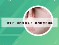 额头上一块白斑 额头上一块白斑怎么回事