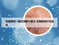 生物制剂一般打到哪个部位 生物制剂打针部位