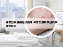 寻常型银屑病组织病理 寻常型银屑病组织病理学特点