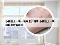 小孩脸上一块一块白怎么回事 小孩脸上一块块白的什么原因