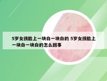 5岁女孩脸上一块白一块白的 5岁女孩脸上一块白一块白的怎么回事