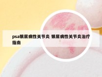 psa银屑病性关节炎 银屑病性关节炎治疗指南