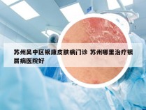 苏州吴中区银康皮肤病门诊 苏州哪里治疗银屑病医院好