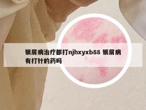 银屑病治疗都打njhxyxb88 银屑病有打针的药吗