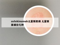 ustekinumab儿童银屑病 儿童银屑病分几种