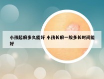 小孩起癣多久能好 小孩长癣一般多长时间能好