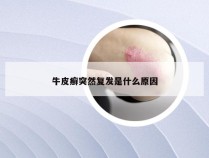 牛皮癣突然复发是什么原因