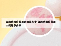 白斑病治疗费用大概是多少 白斑病治疗费用大概是多少啊