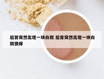 后背突然出现一块白斑 后背突然出现一块白斑很痒