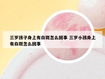 三岁孩子身上有白斑怎么回事 三岁小孩身上有白斑怎么回事