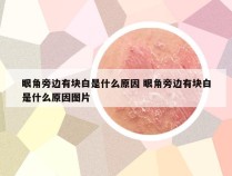 眼角旁边有块白是什么原因 眼角旁边有块白是什么原因图片