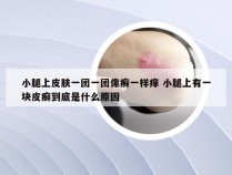 小腿上皮肤一团一团像癣一样痒 小腿上有一块皮癣到底是什么原因