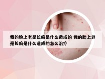 我的脸上老是长癣是什么造成的 我的脸上老是长癣是什么造成的怎么治疗