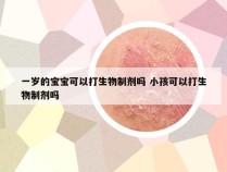 一岁的宝宝可以打生物制剂吗 小孩可以打生物制剂吗