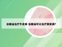 谷糠油治疗牛皮癣 谷糠油可以治疗银屑病?