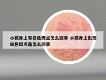 小孩身上有白色斑点怎么回事 小孩身上出现白色斑点是怎么回事