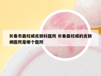 长春市最权威皮肤科医院 长春最权威的皮肤病医院是哪个医院