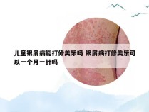 儿童银屑病能打修美乐吗 银屑病打修美乐可以一个月一针吗