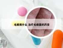 毛癣用什么 治疗毛癣菌的药膏