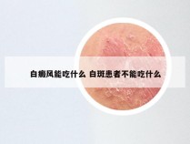 白癜风能吃什么 白斑患者不能吃什么