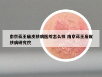 南京蒋王庙皮肤病医院怎么样 南京蒋王庙皮肤病研究院