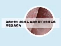 白斑患者可以吃什么 白斑患者可以吃什么水果增强免疫力