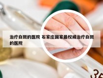 治疗白斑的医院 石家庄国家最权威治疗白斑的医院