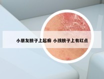 小朋友膀子上起癣 小孩膀子上有红点