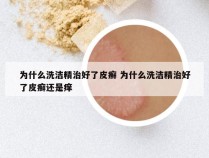 为什么洗洁精治好了皮癣 为什么洗洁精治好了皮癣还是痒