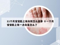 11个月宝宝脸上有白斑怎么回事 十一个月宝宝脸上有一点白是怎么了