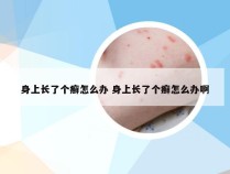 身上长了个癣怎么办 身上长了个癣怎么办啊