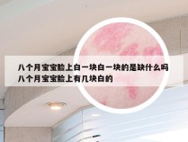 八个月宝宝脸上白一块白一块的是缺什么吗 八个月宝宝脸上有几块白的