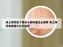 身上突然出了很多小癣块是怎么回事 身上突然有癣是什么引起的