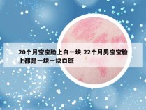 20个月宝宝脸上白一块 22个月男宝宝脸上都是一块一块白斑