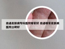 南通皮肤病专科医院哪家好 南通哪家皮肤病医院口碑好