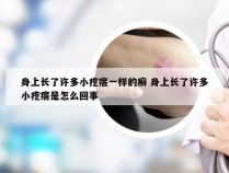 身上长了许多小疙瘩一样的癣 身上长了许多小疙瘩是怎么回事