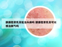 酮康他索乳膏能治头癣吗 酮康他索乳膏可以根治脚气吗