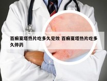 百癣夏塔热片吃多久见效 百癣夏塔热片吃多久停药