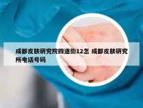 成都皮肤研究院四道街12怎 成都皮肤研究所电话号码