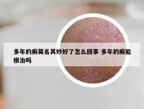 多年的癣莫名其妙好了怎么回事 多年的癣能根治吗