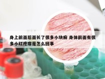 身上前面后面长了很多小块癣 身体前面有很多小红疙瘩是怎么回事