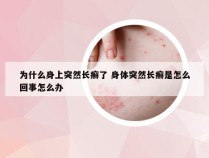 为什么身上突然长癣了 身体突然长癣是怎么回事怎么办