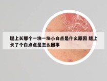 腿上长那个一块一块小白点是什么原因 腿上长了个白点点是怎么回事