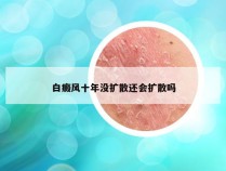 白癜风十年没扩散还会扩散吗