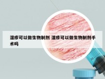 湿疹可以做生物制剂 湿疹可以做生物制剂手术吗