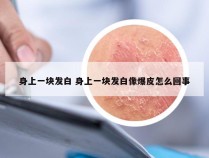 身上一块发白 身上一块发白像爆皮怎么回事