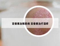 百香果治银屑病 百香果治疗湿疹