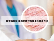 稀饭癣症状 稀饭的功效与作用及食用方法